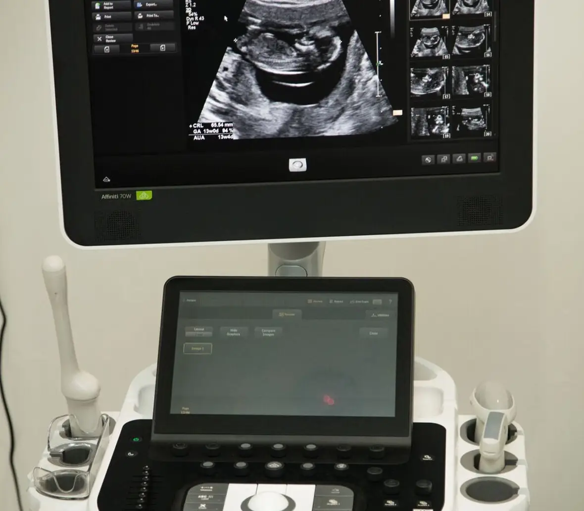 advanced imaging and ultrasound equipment | obstetric ultrasound near me